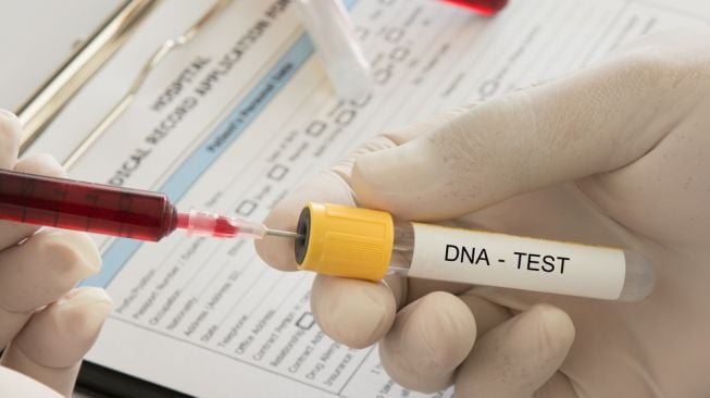 Tes Genetik: Membuka Tabir Informasi Kesehatan dari DNA Anda