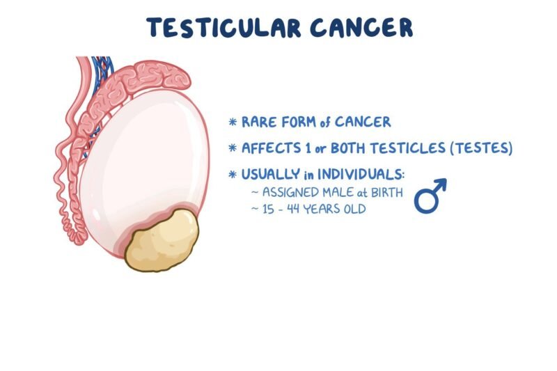 Kanker Testis: Mengenal, Mencegah, dan Mengatasi Ancaman pada Kesehatan Pria