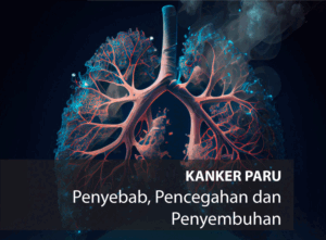 Tentu, mari kita bahas kanker paru-paru dalam artikel yang informatif dan mudah dipahami.