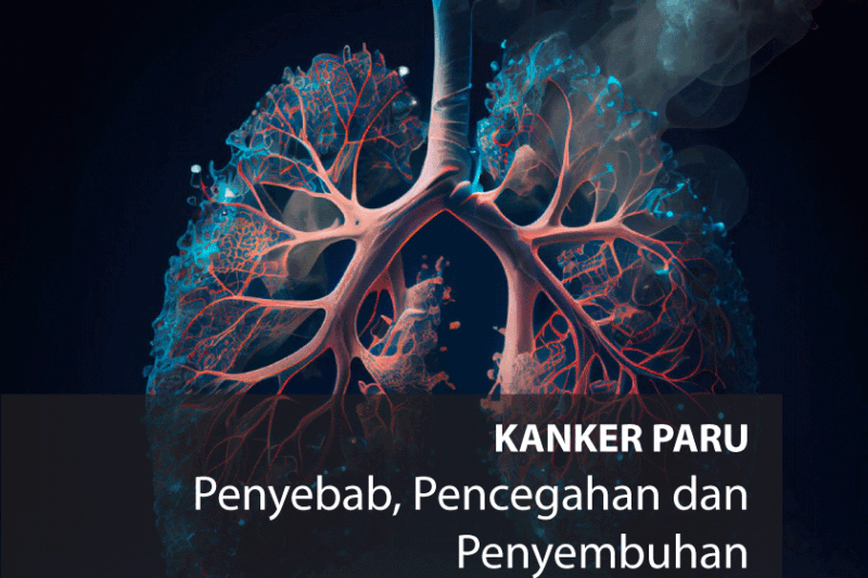 Tentu, mari kita bahas kanker paru-paru dalam artikel yang informatif dan mudah dipahami.