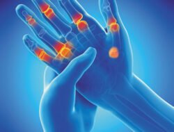 Arthritis: Musuh Sendi yang Mengganggu Kualitas Hidup