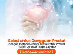 Kesehatan Prostat: Memahami, Mencegah, dan Menangani Masalahnya